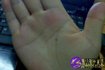 生命线上有痣代表着什么？(图文)